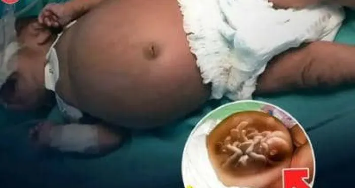 quand-la-science-depasse-la-fiction-lincroyable-histoire-du-bebe-enceinte