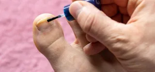 ongles-jaunes-ce-que-la-couleur-revele-sur-votre-sante