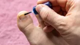 ongles jaunes ce que la couleur revele sur votre sante