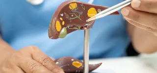 cancer-du-foie-le-nombre-de-cas-pourrait-doubler-dici-a-2050