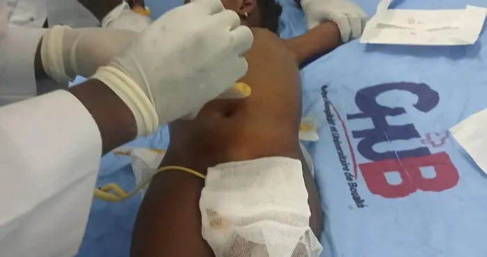 bouake-le-chu-reussit-sa-premiere-dialyse-peritoneale-une-avancee-medicale-majeure