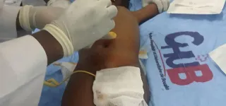 bouake-le-chu-reussit-sa-premiere-dialyse-peritoneale-une-avancee-medicale-majeure