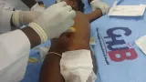 bouake le chu reussit sa premiere dialyse peritoneale une avancee medicale majeure