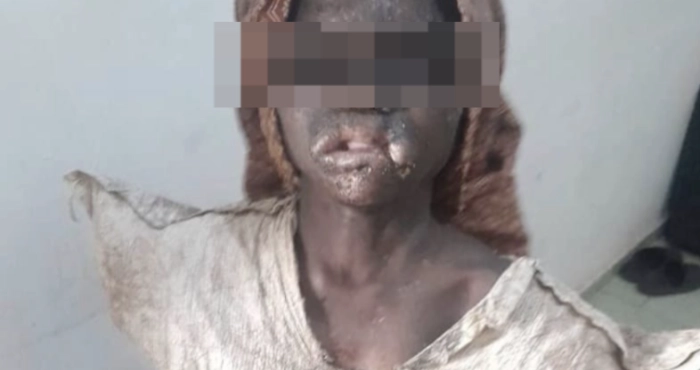 maltraitance-denfant-soumise-a-un-traitement-inhumain-une-fillette-de-11-arrachee-de-lenfer-de-sa-grand-mere