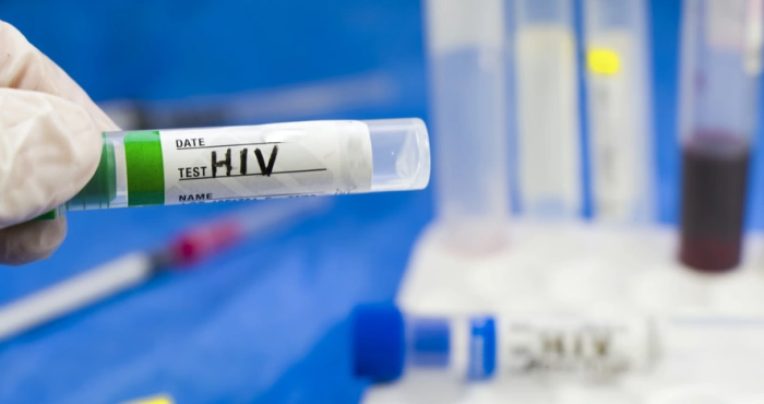 un-homme-de-63-ans-guerit-du-sida-et-dun-cancer