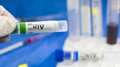 un-homme-de-63-ans-guerit-du-sida-et-dun-cancer