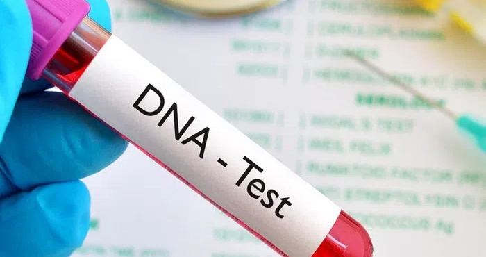 ghana-42-3-des-tests-adn-effectues-en-2025-montrent-que-les-hommes-testes-ne-sont-pas-les-peres-biologiques-selon-une-etude