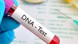 ghana-42-3-des-tests-adn-effectues-en-2025-montrent-que-les-hommes-testes-ne-sont-pas-les-peres-biologiques-selon-une-etude