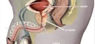 allo-docteur-tout-savoir-sur-le-cancer-de-la-prostate