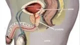 allo docteur tout savoir sur le cancer de la prostate