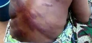 affaire-une-institutrice-se-fait-bastonner-a-abobo-le-procureur-adou-richard-se-saisit-du-dossier