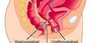 dr-kouadio-paul-programme-de-la-sante-de-la-mere-et-de-lenfant-on-peut-contracter-la-maladie-a-tout-age