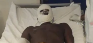 korhogo-des-personnes-brulees-a-lexplosion-dun-camion-citerne-de-carburant