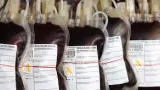acces aux produits sanguins les poches de sang disponibles effectivement a 3000 fcfa