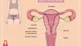 allo docteur lendometriose une maladie feminine ignoree